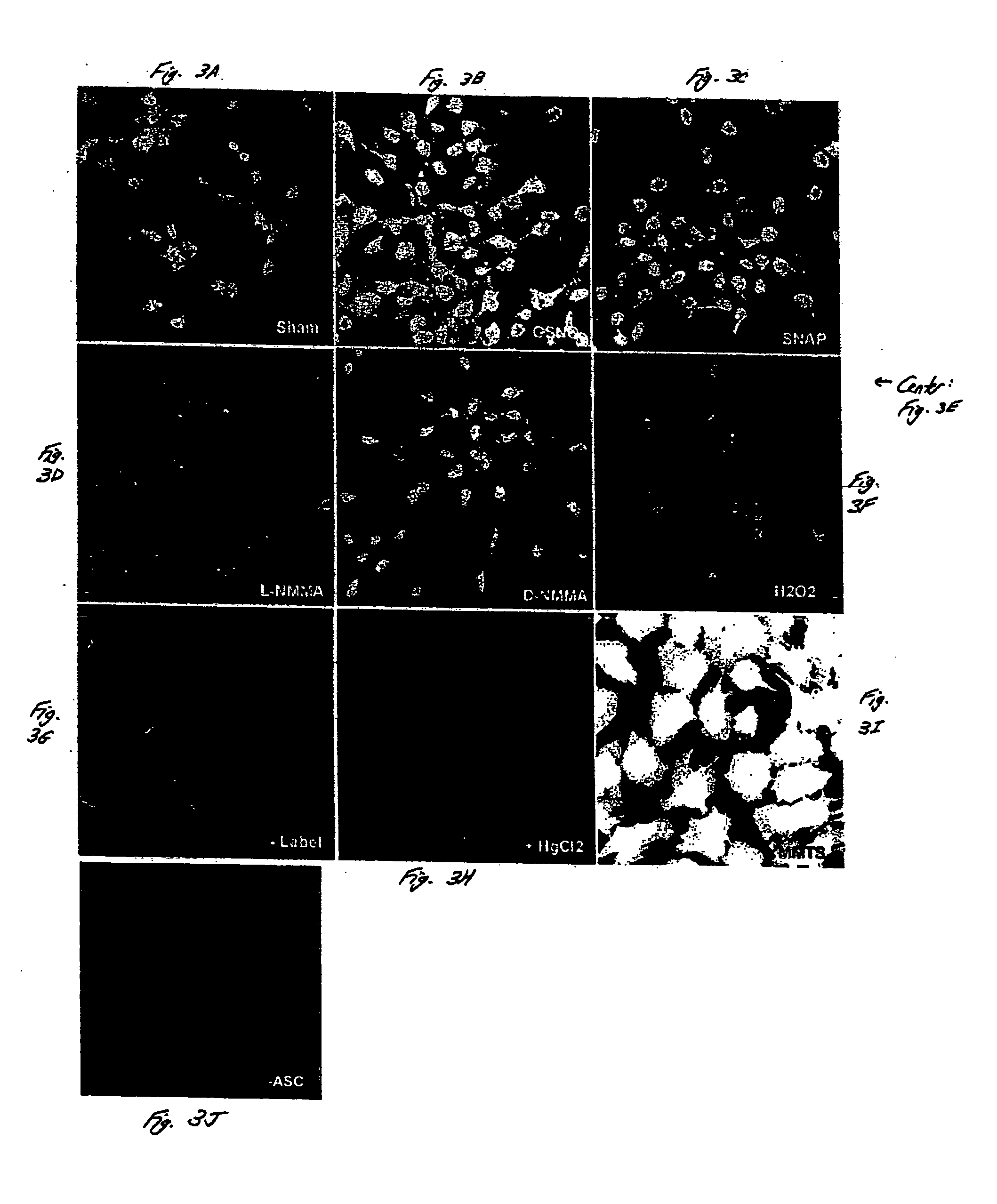 Detection of nitrosylated proteins