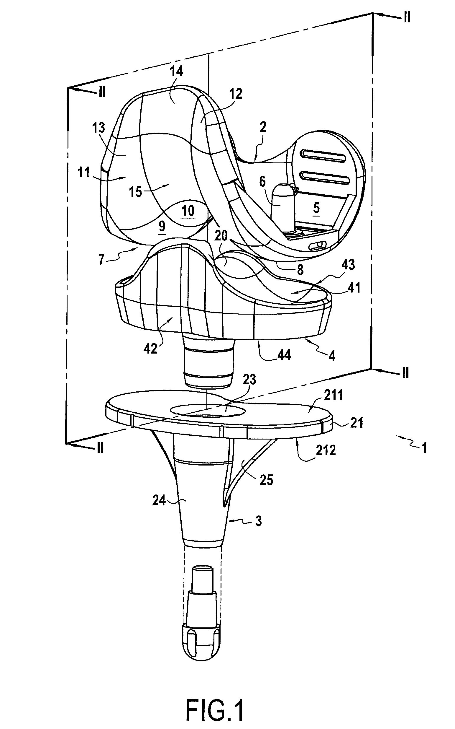 Total knee prosthesis