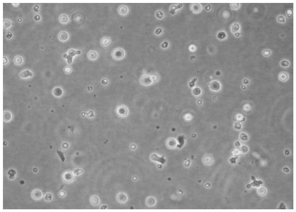 NKT (Natural Killer T) cell preparation prepared by sensitization by using tumor cells and simulating factors and preparation method of NKT cell preparation