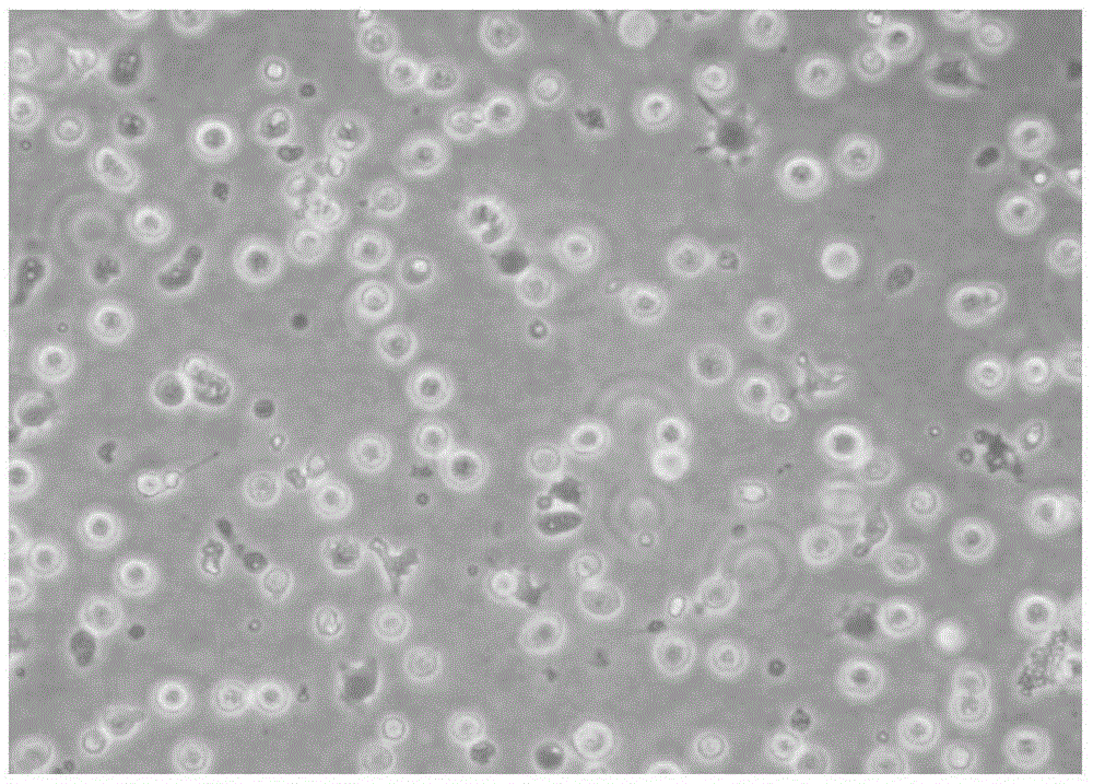 NKT (Natural Killer T) cell preparation prepared by sensitization by using tumor cells and simulating factors and preparation method of NKT cell preparation