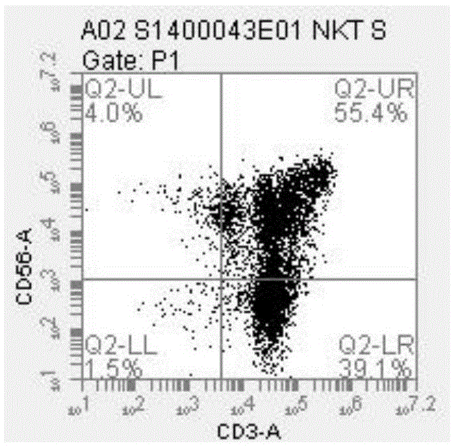 NKT (Natural Killer T) cell preparation prepared by sensitization by using tumor cells and simulating factors and preparation method of NKT cell preparation