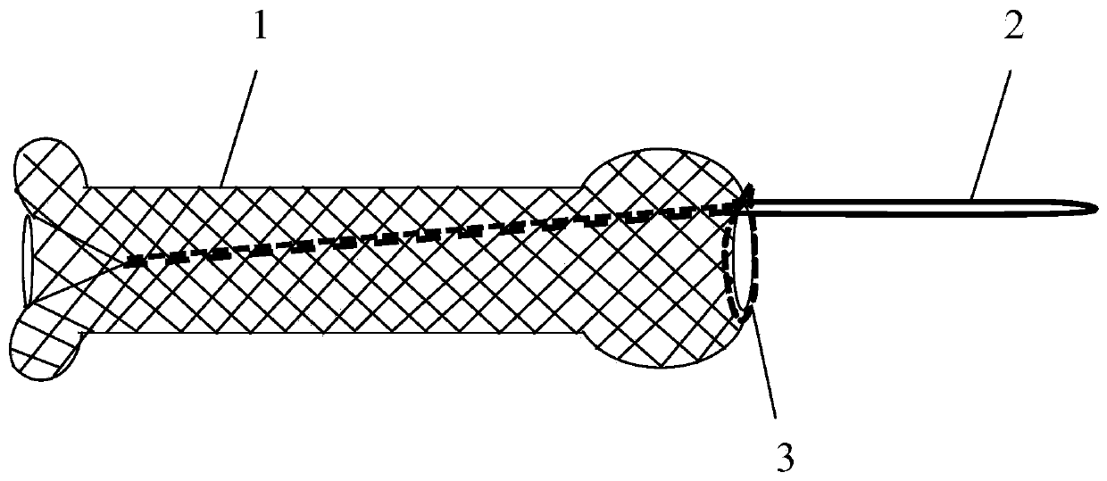 Full-film-coated self-expanding recyclable biliary tract metal stent