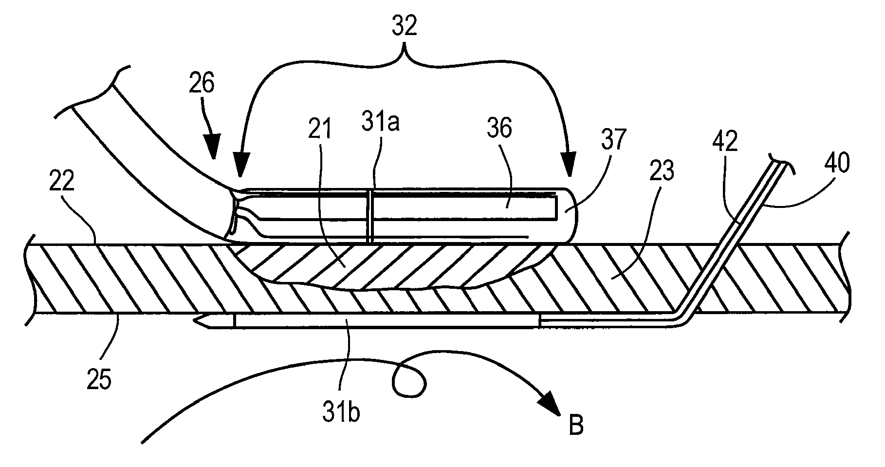 Apparatus and method for assessing transmurality of a tissue ablation