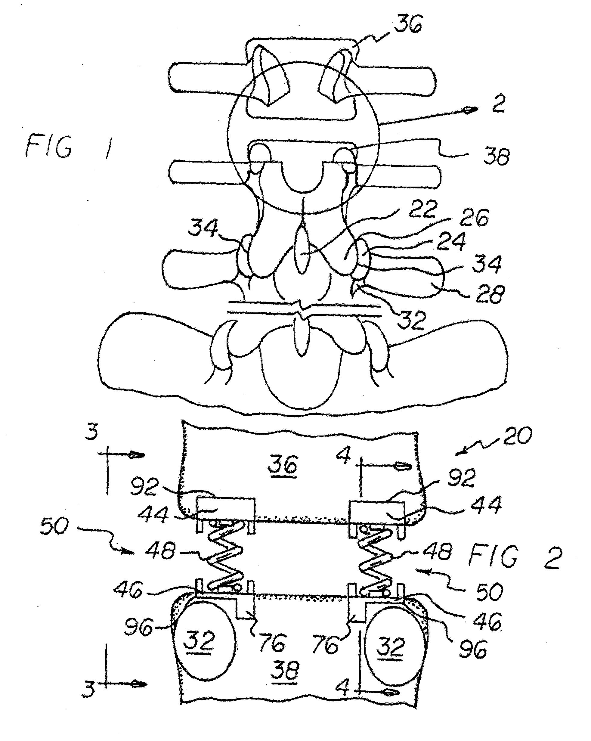 Vertebral implants adapted for posterior insertion