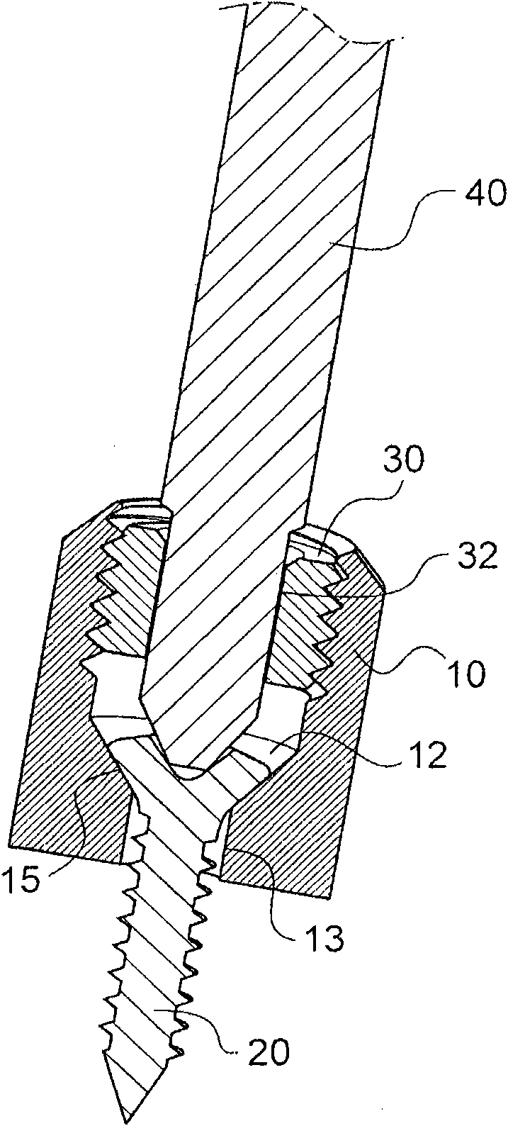 wire clip