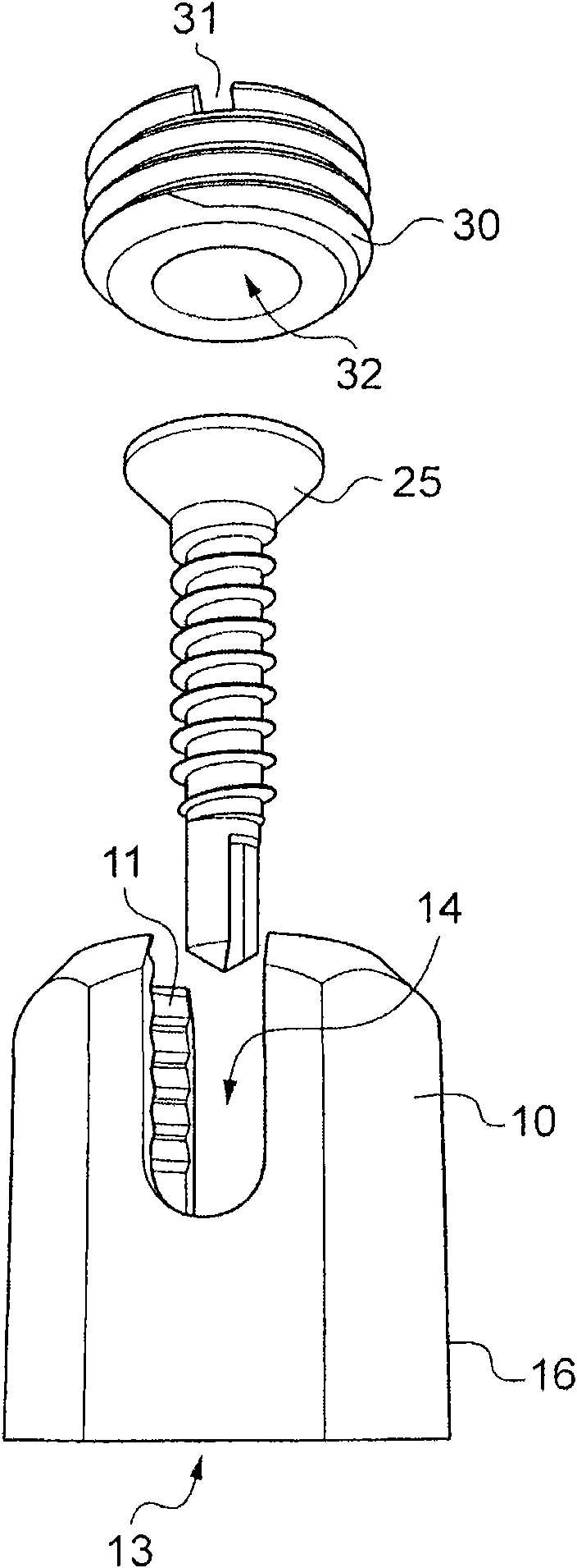 wire clip