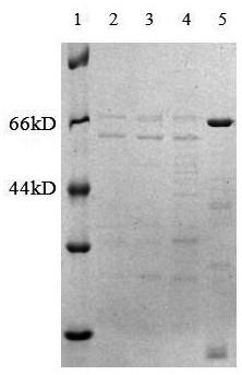 Preparation method of α-amylase