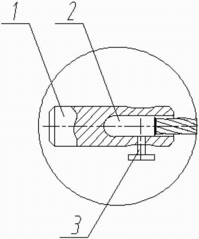 A stent delivery system