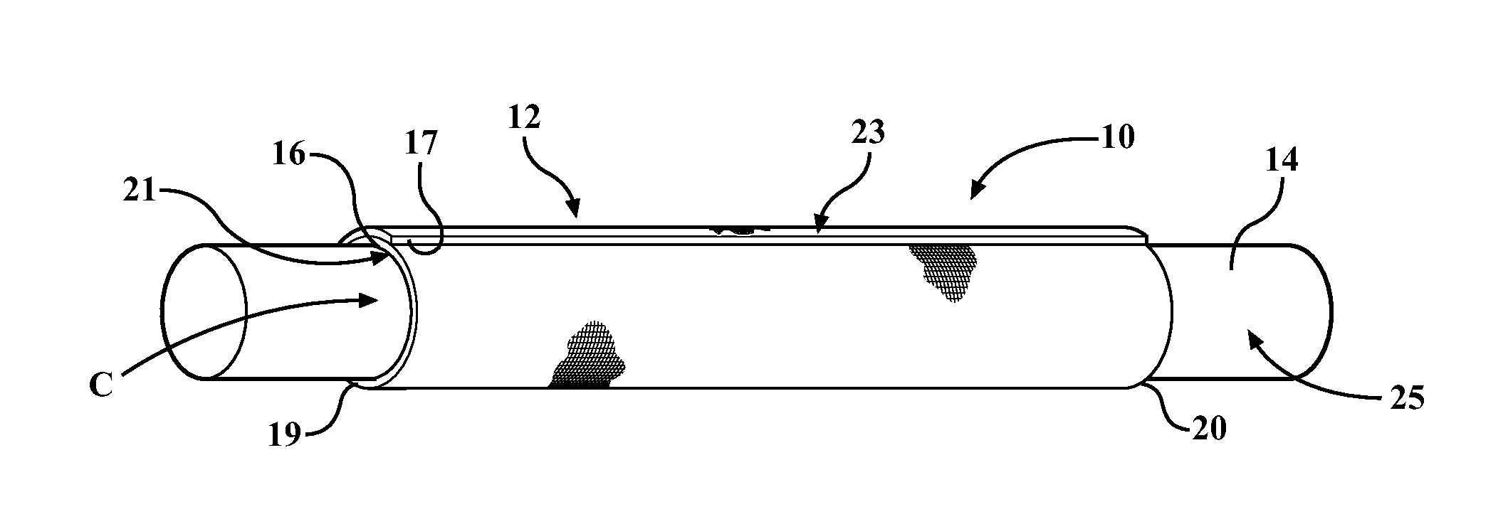 Textile sleeve with adhesive fixation layer and methods of construction and use thereof