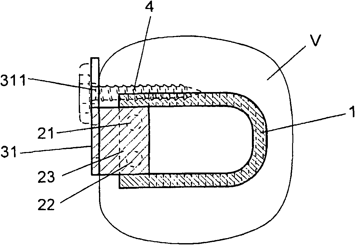 Vertebral cage device with modular fixation