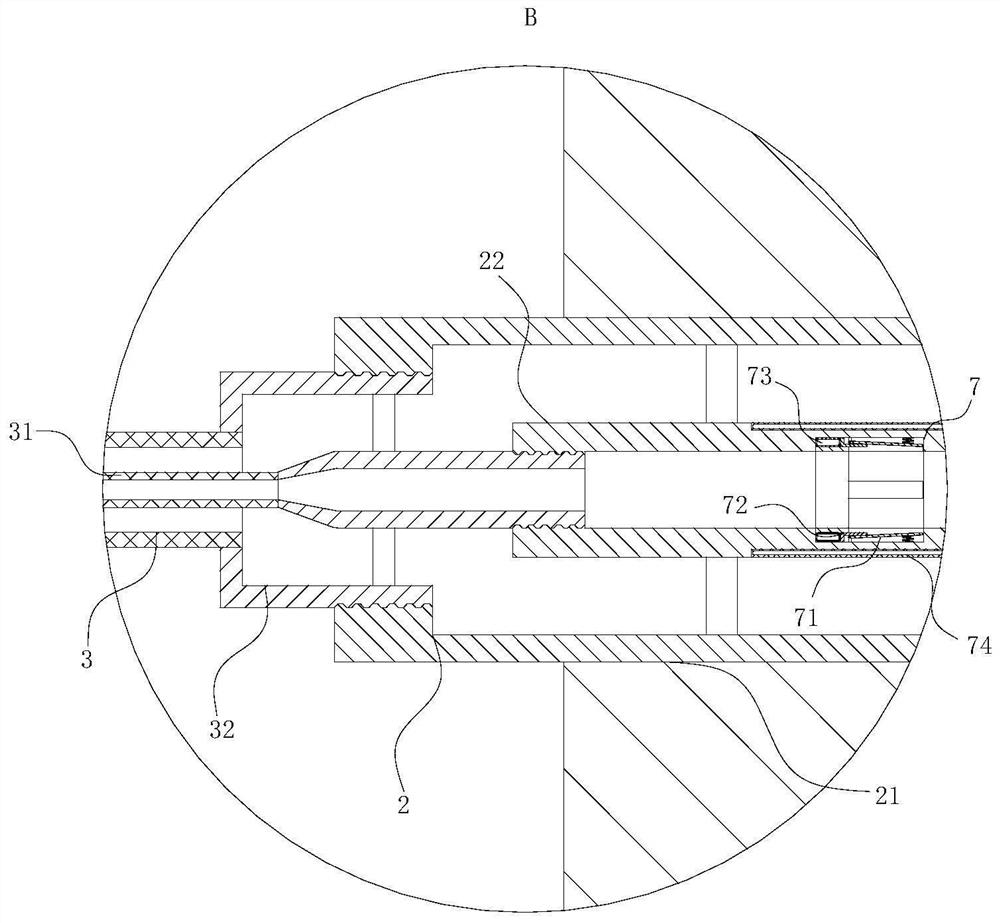 Negative pressure gastric lavage device for pediatricians