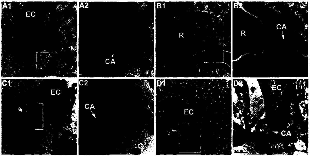 Application of borneol as active ingredient of drug for relieving ultrasound targeted microbubble destruction induced focal cerebral ischemia blood-brain barrier opening