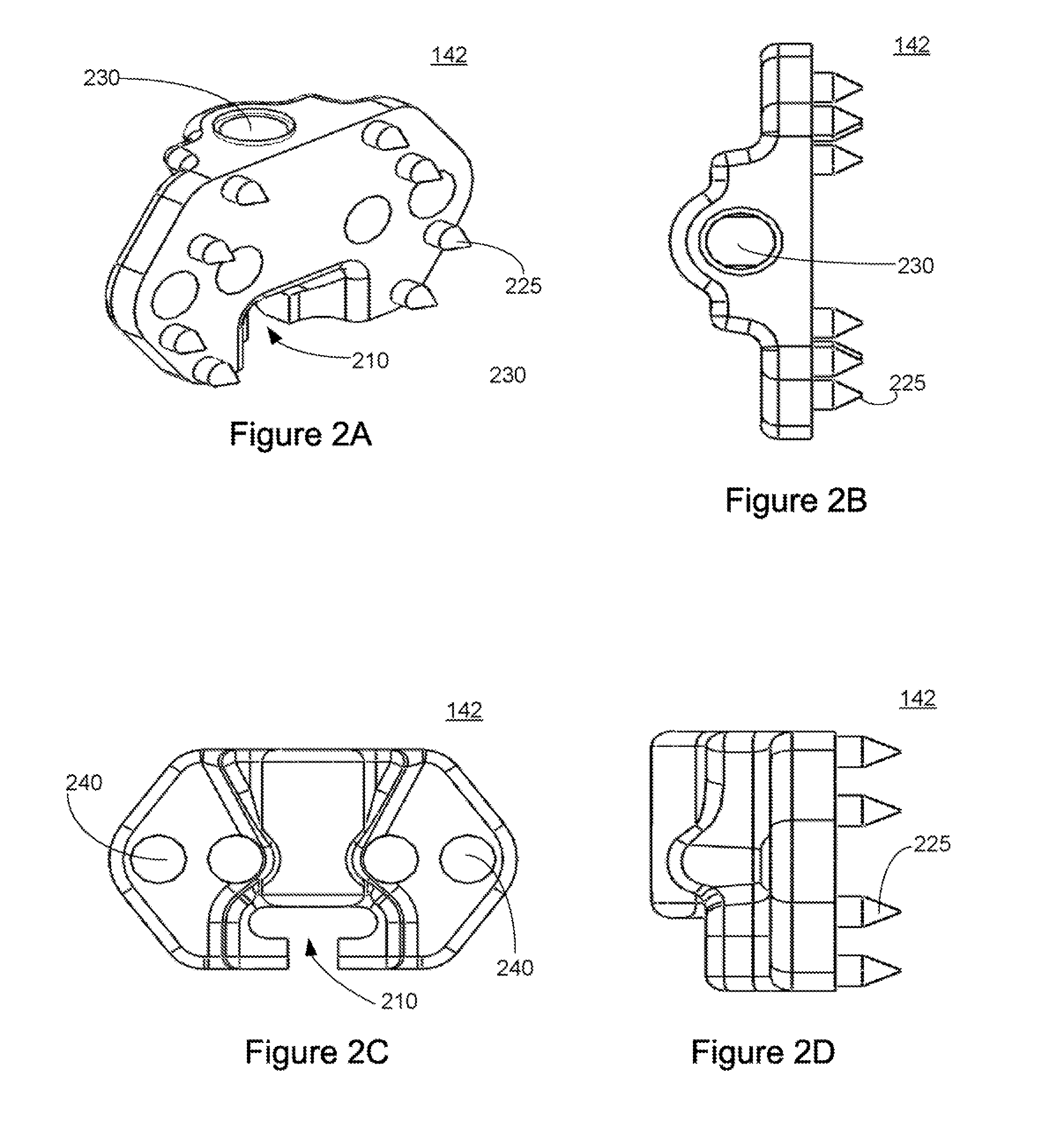 Implantation Tools for Interspinous Process Spacing Device