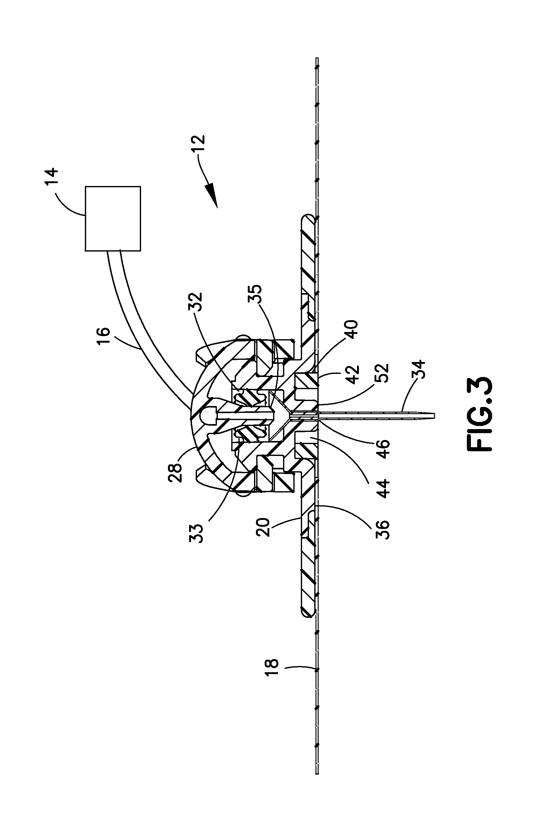 Infusion site leak detection device