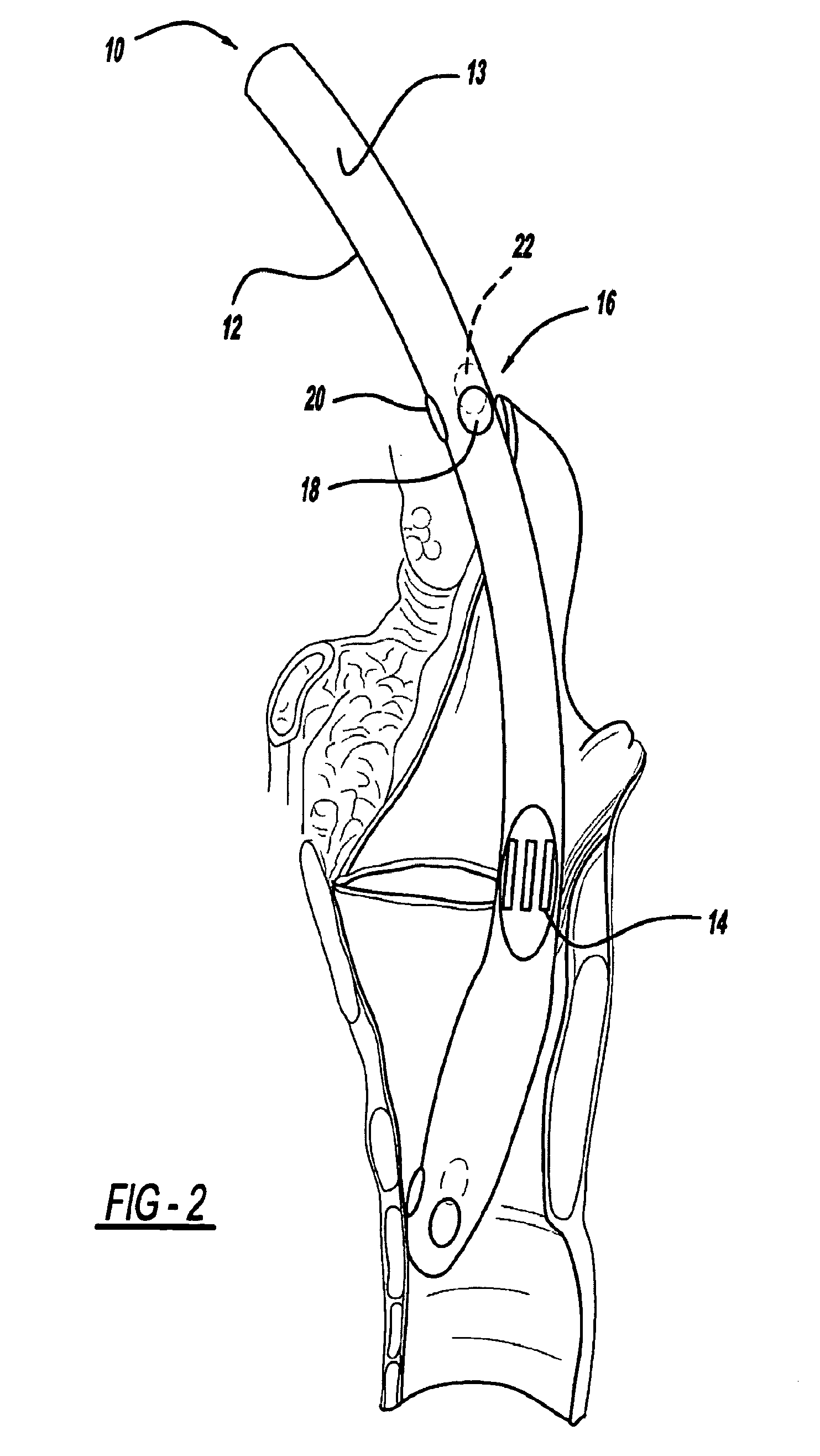 Nerve monitoring device