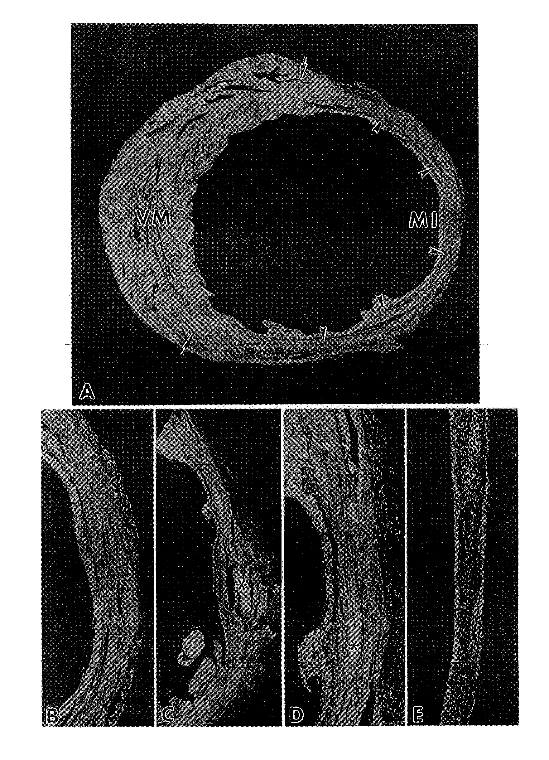 Methods and compositions for the repair and/or regeneration of damaged myocardium