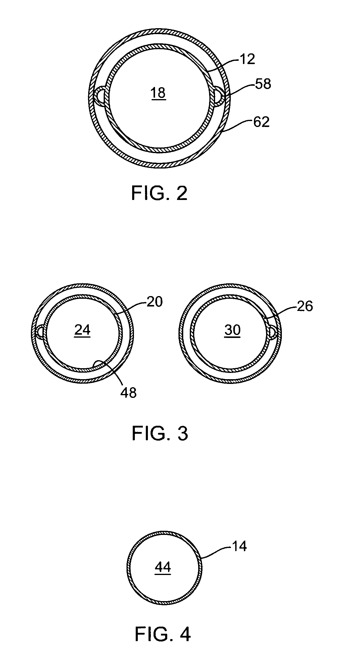 Hybrid modular endovascular graft