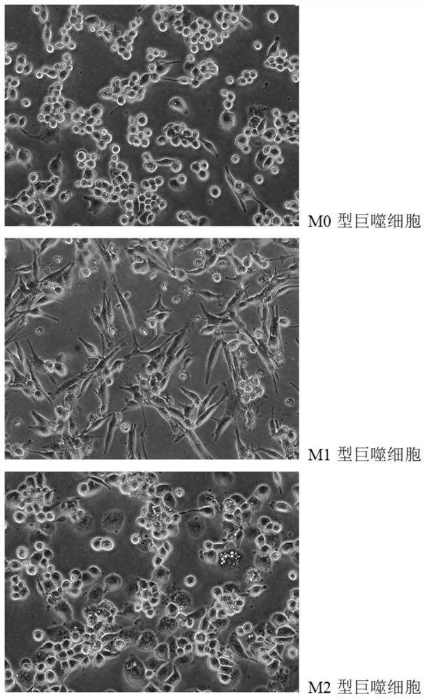 Identification method and application of M1 type macrophages