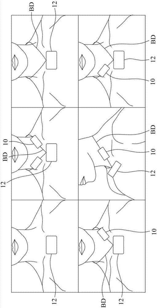 Physiological signal sensing device