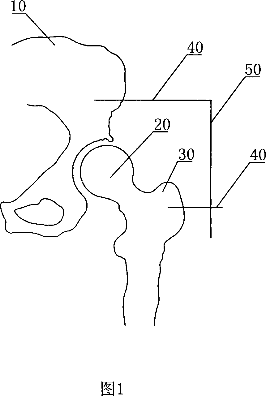 Lower limbs isometric measuring device used for all-hip joint displacement operation