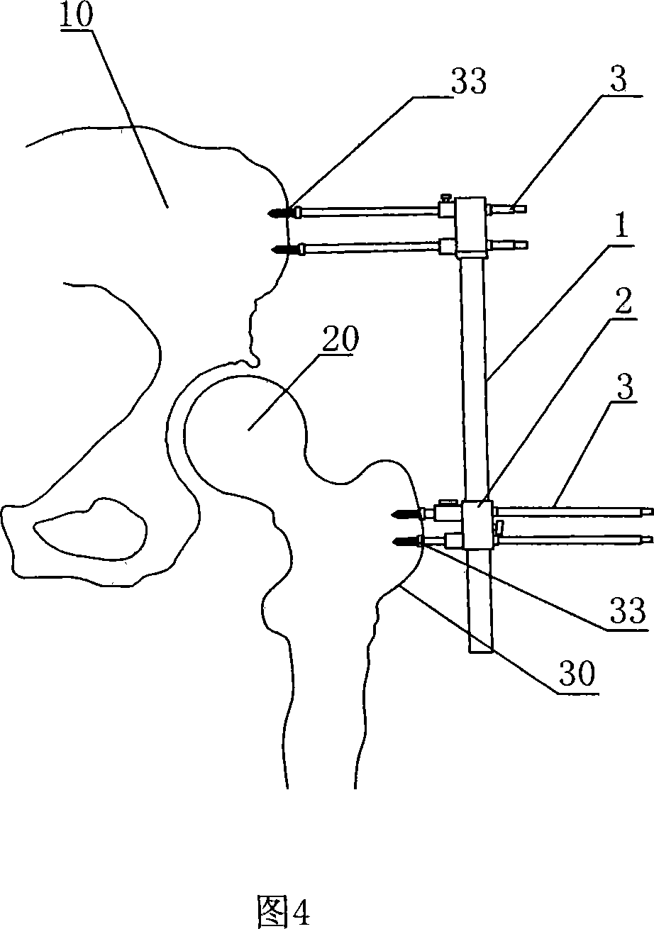 Lower limbs isometric measuring device used for all-hip joint displacement operation