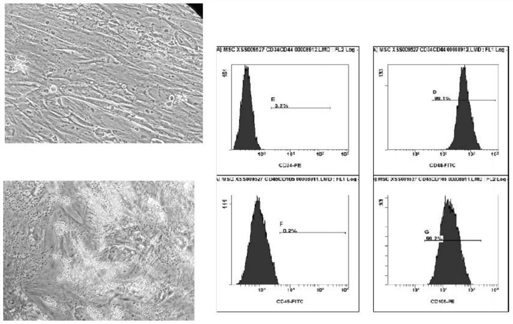 Preparation and cryopreservation method and application of human placental villous tissue