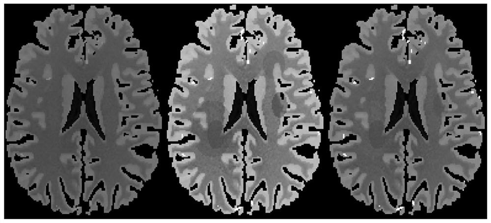 Low-dose cerebral perfusion CT reconstruction method based on prior image constraint diffusion tensor