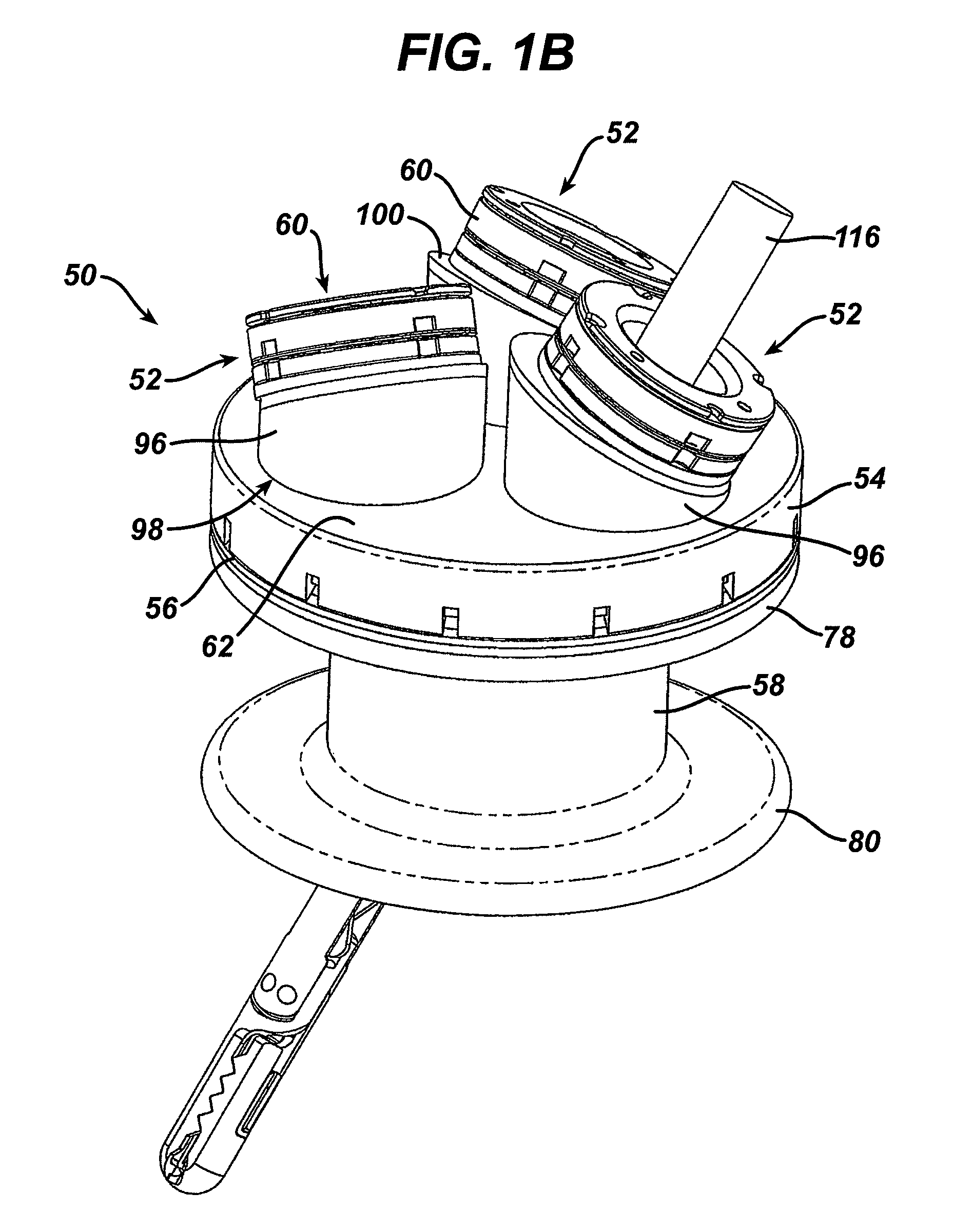 Variable Surgical Access Device