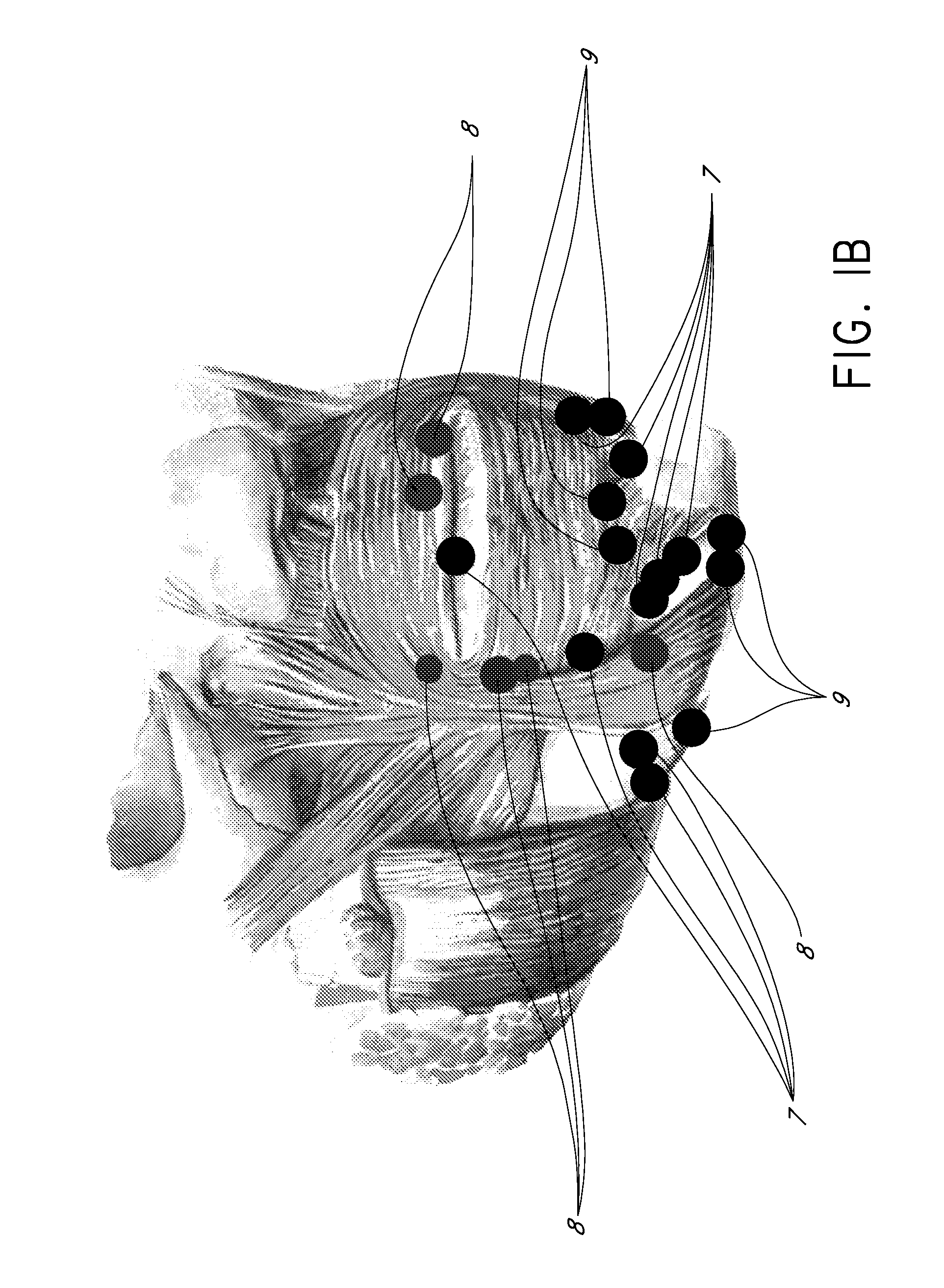 Methods for Identifying Areas of a Subject's Skin that Appear to Lack Volume