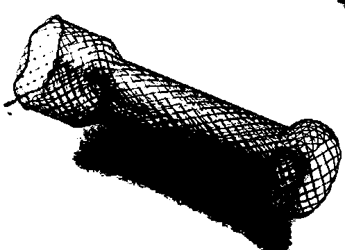 Method for coating esophageal stent through melt electrospinning