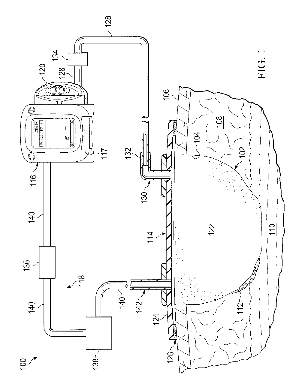 Wound debridement by irrigation with ultrasonically activated microbubbles