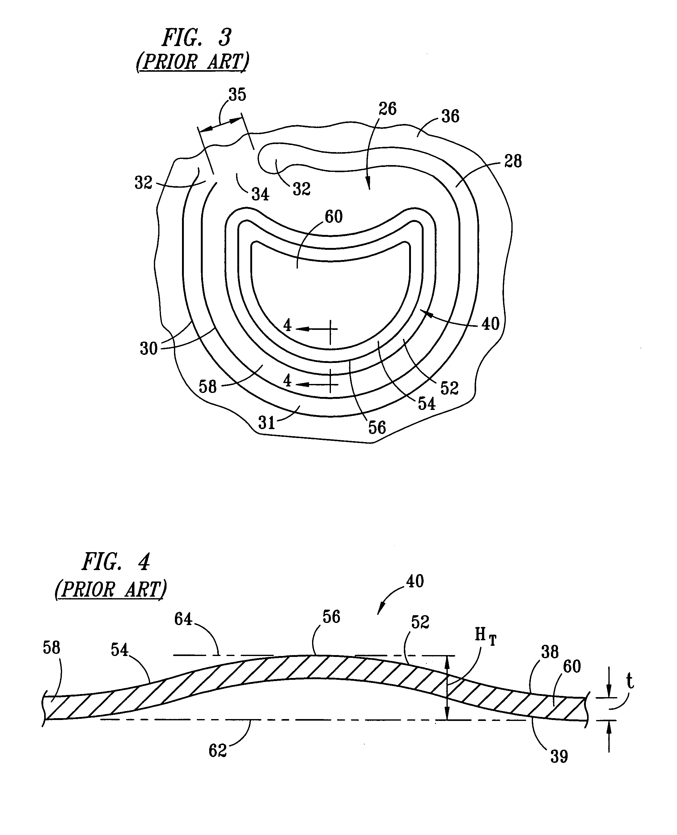 Stay-on-tab container closure having tear panel with low-relief contour features on the upper surface