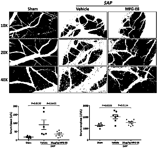 Application of breast milk fat globule cuticle growth factor 8 to preparation of drugs for preventing/treating serious acute pancreatitis