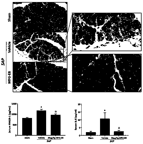 Application of breast milk fat globule cuticle growth factor 8 to preparation of drugs for preventing/treating serious acute pancreatitis