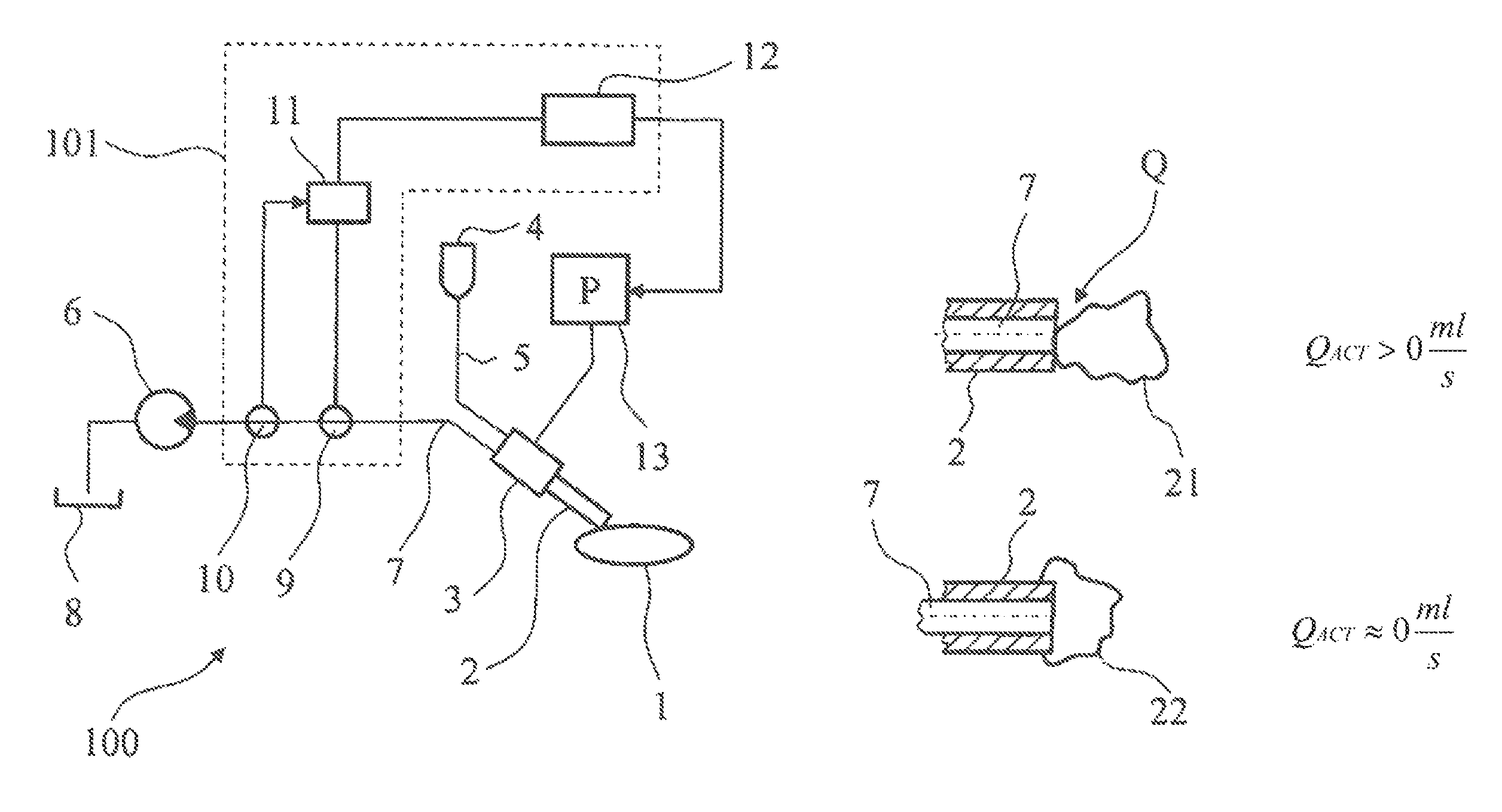 Ophthalmic surgical system and a control apparatus therefor