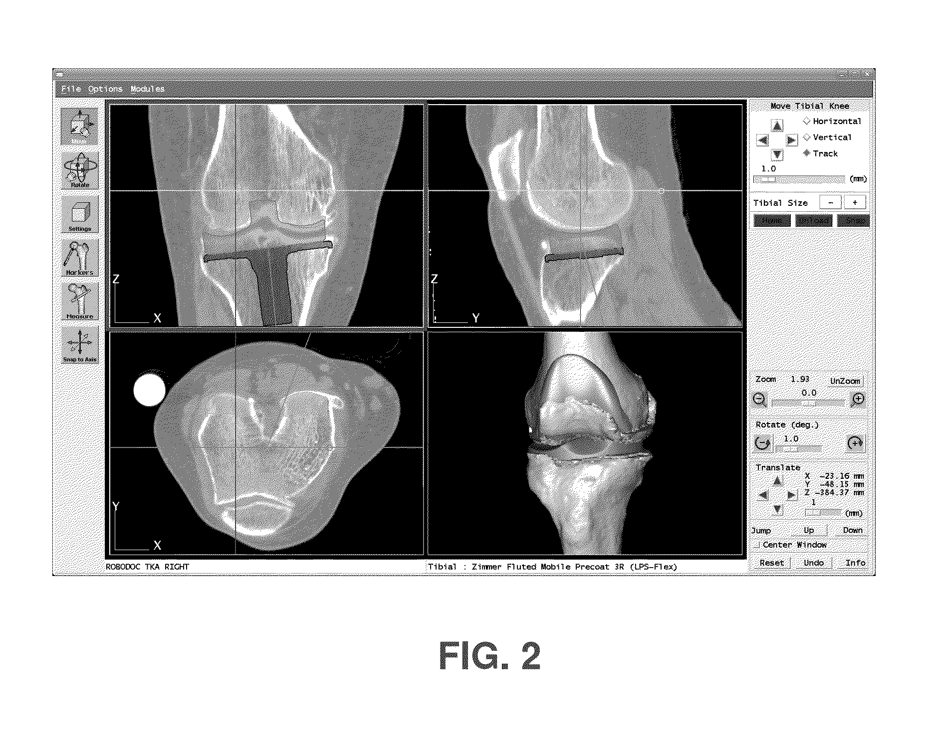 Method and apparatus for generating a tool path for a robotic orthopedic surgical procedure