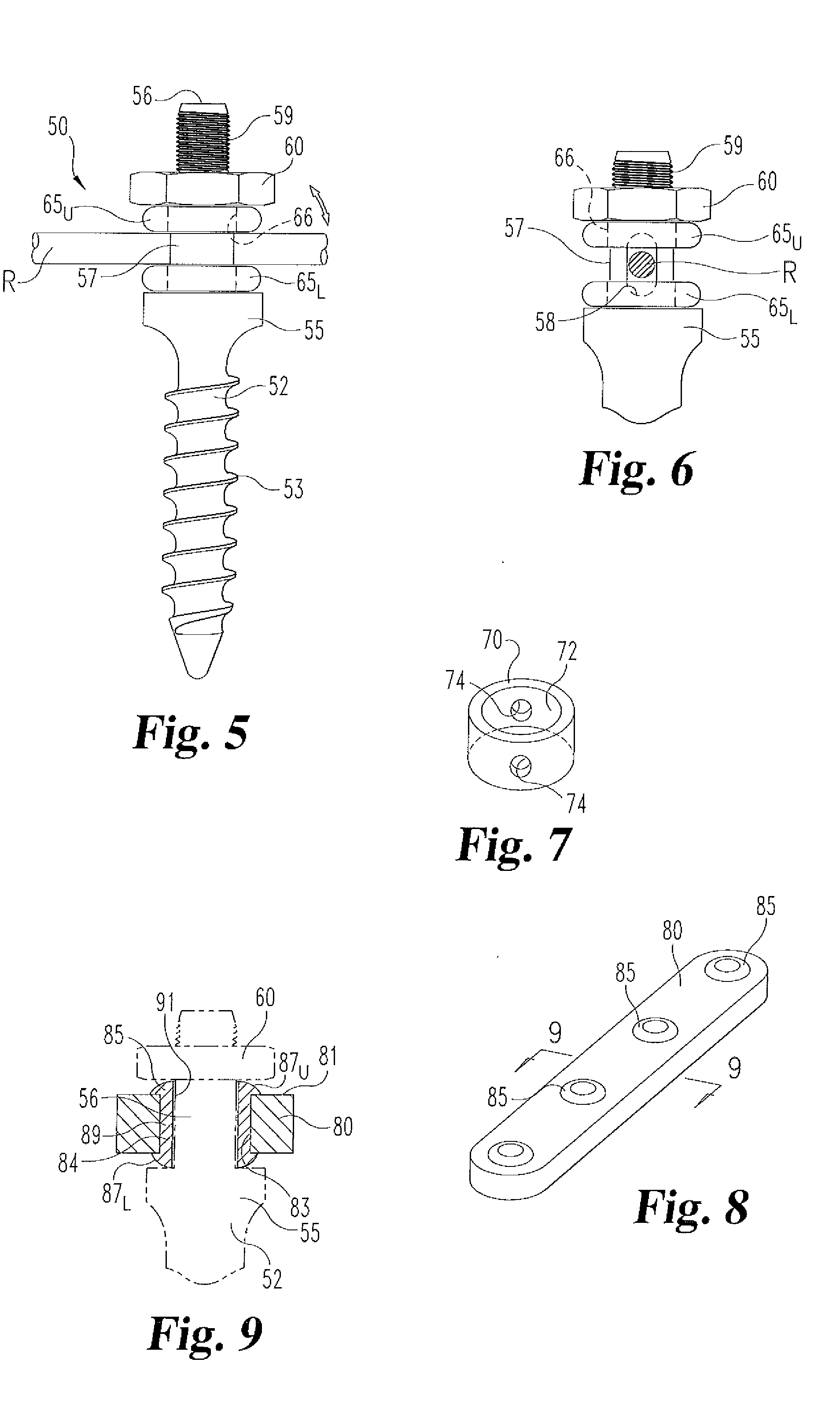 Dynamic Spinal Stabilization System