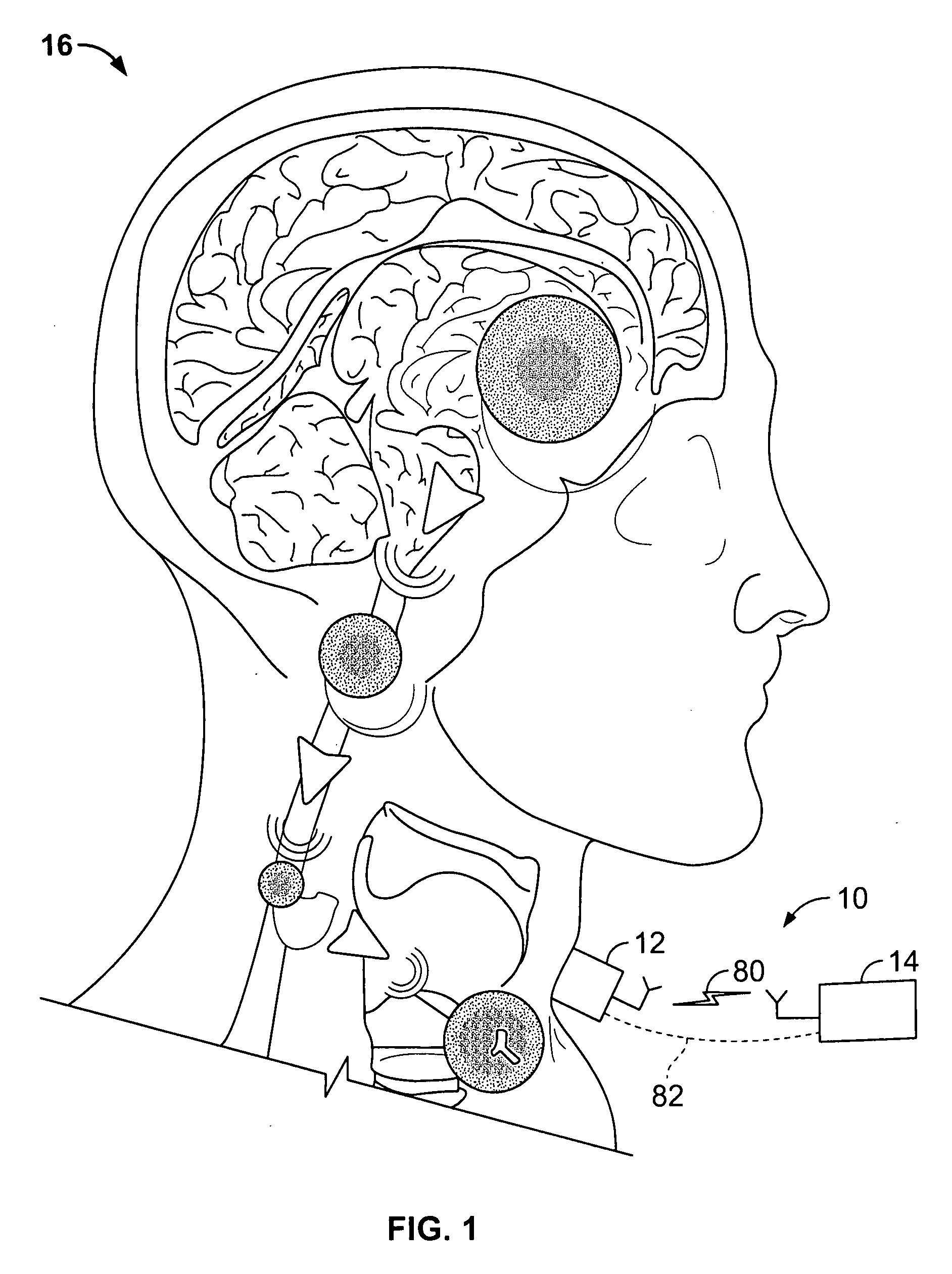 Neural translator