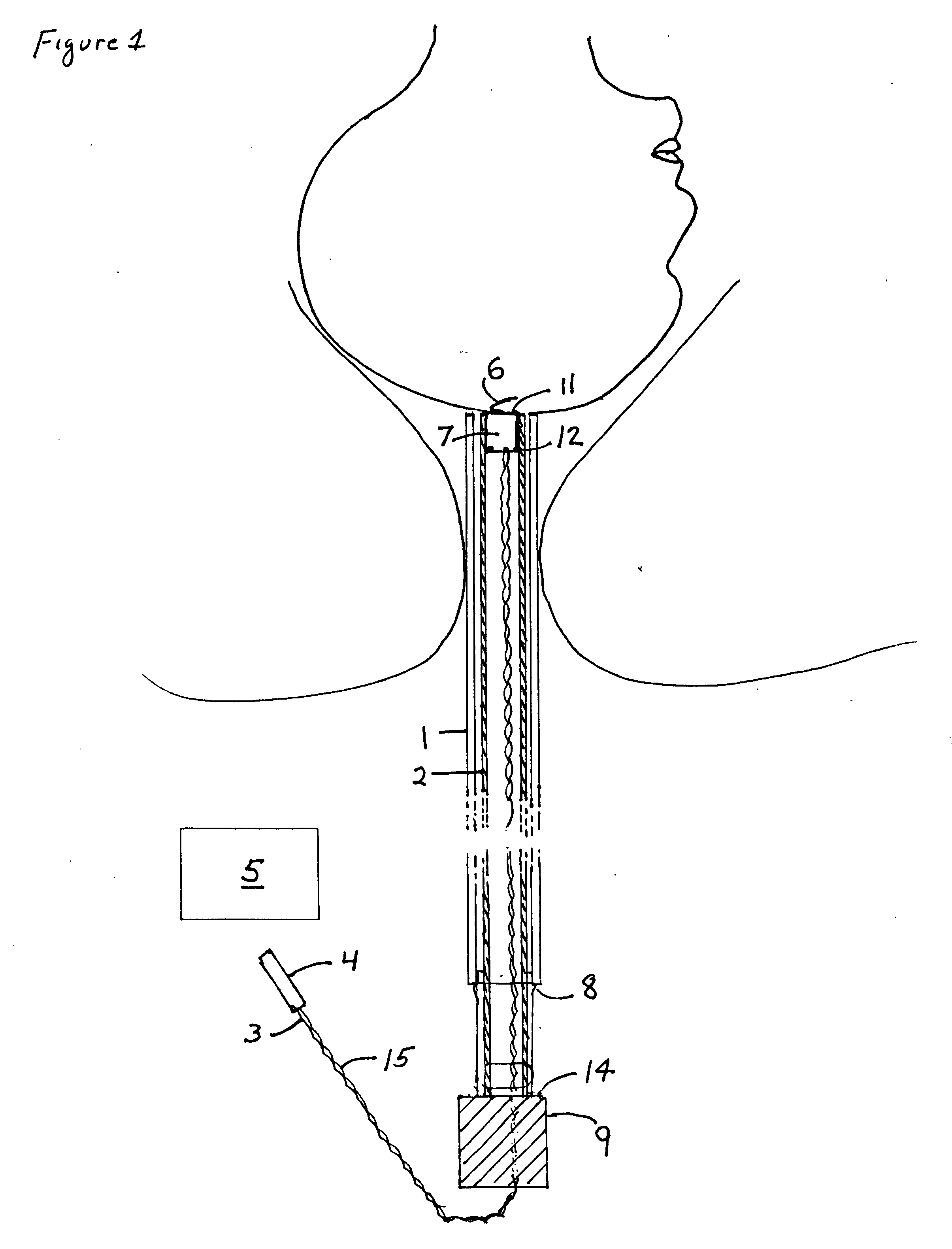 System for monitoring fetal status