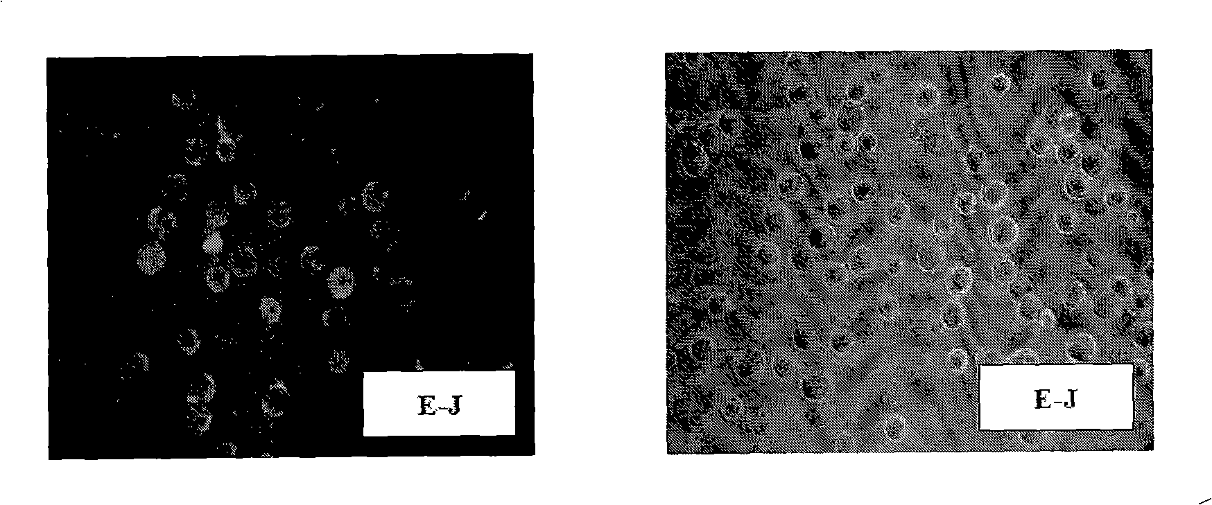 Hybrid tumor, antihuman bladder cancer monoantibody and guide medicament, and bladder cancer diagnosis agent