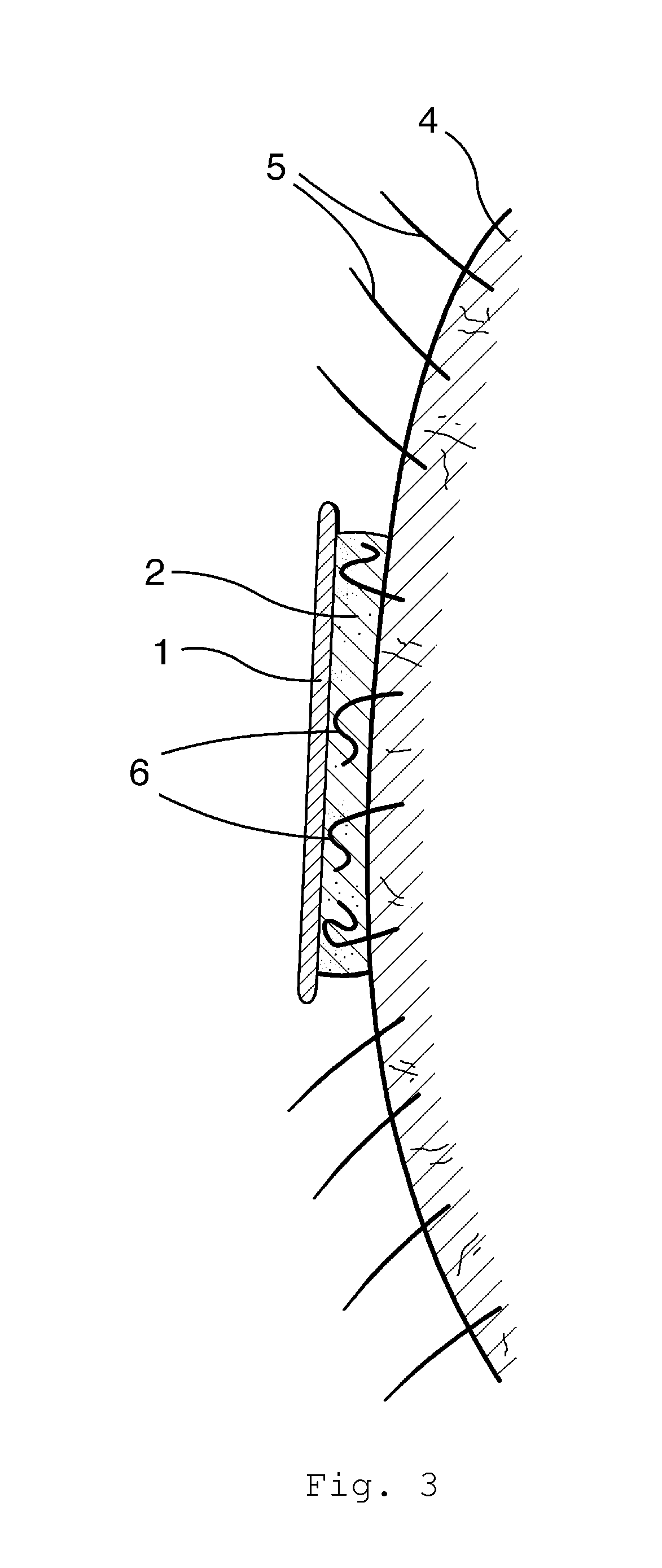 Conformable Depilatory Article