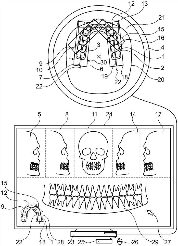 Method for capturing dental objects