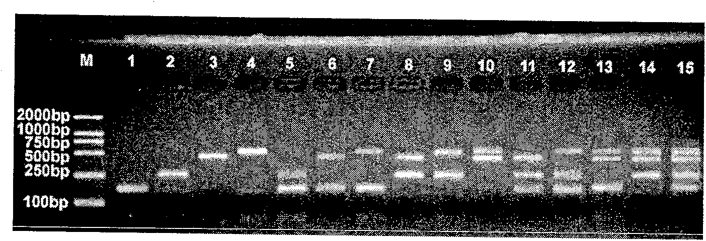 Multiple PCR detection reagent kit for pathogenic bacterium and its detecting method