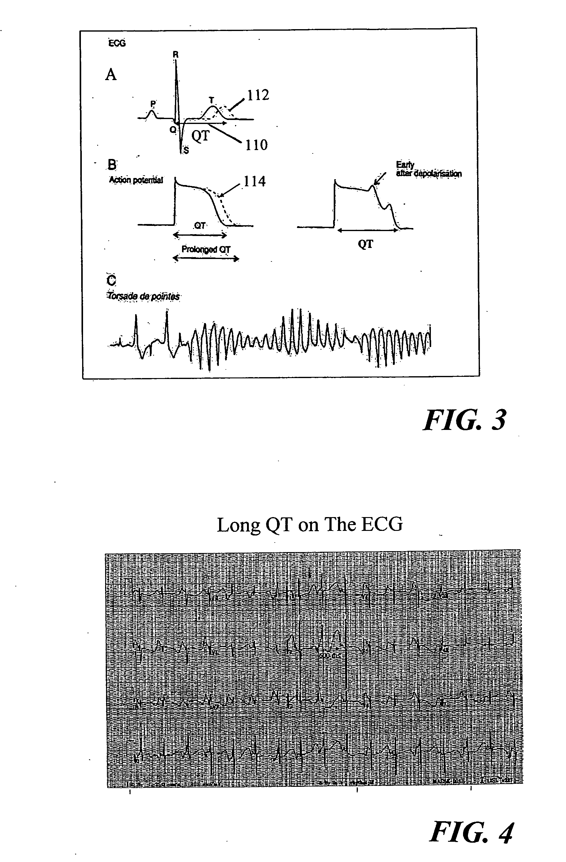 Method of drug therapy in treatment of cardiac arrhythmias