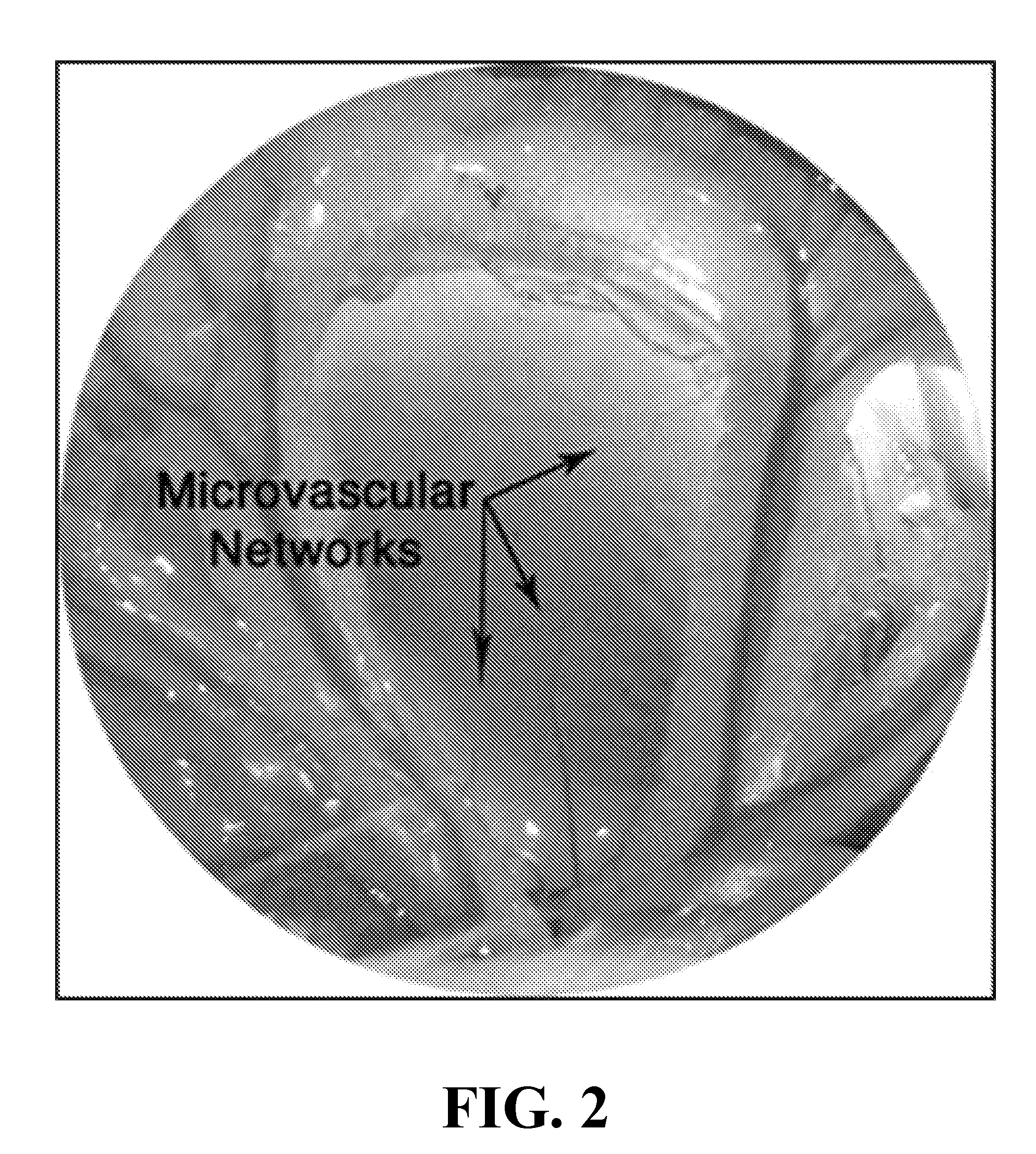 Topical Poloxamer Formulations for Enhancing Microvascular Flow: Compositions and Uses Thereof