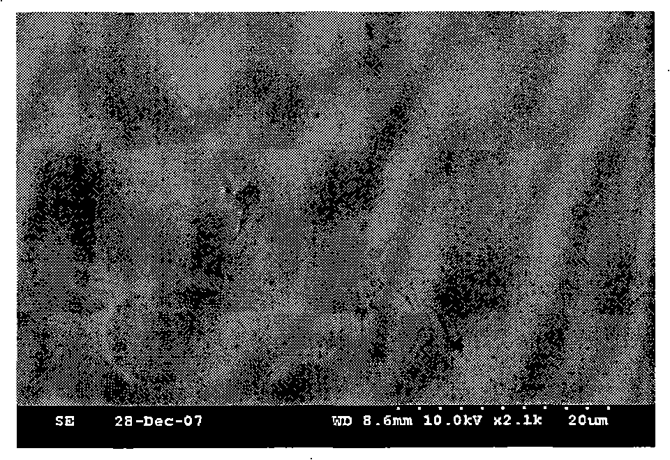 Radionuclide particle implantation medicine for cancer, use and preparation method thereof