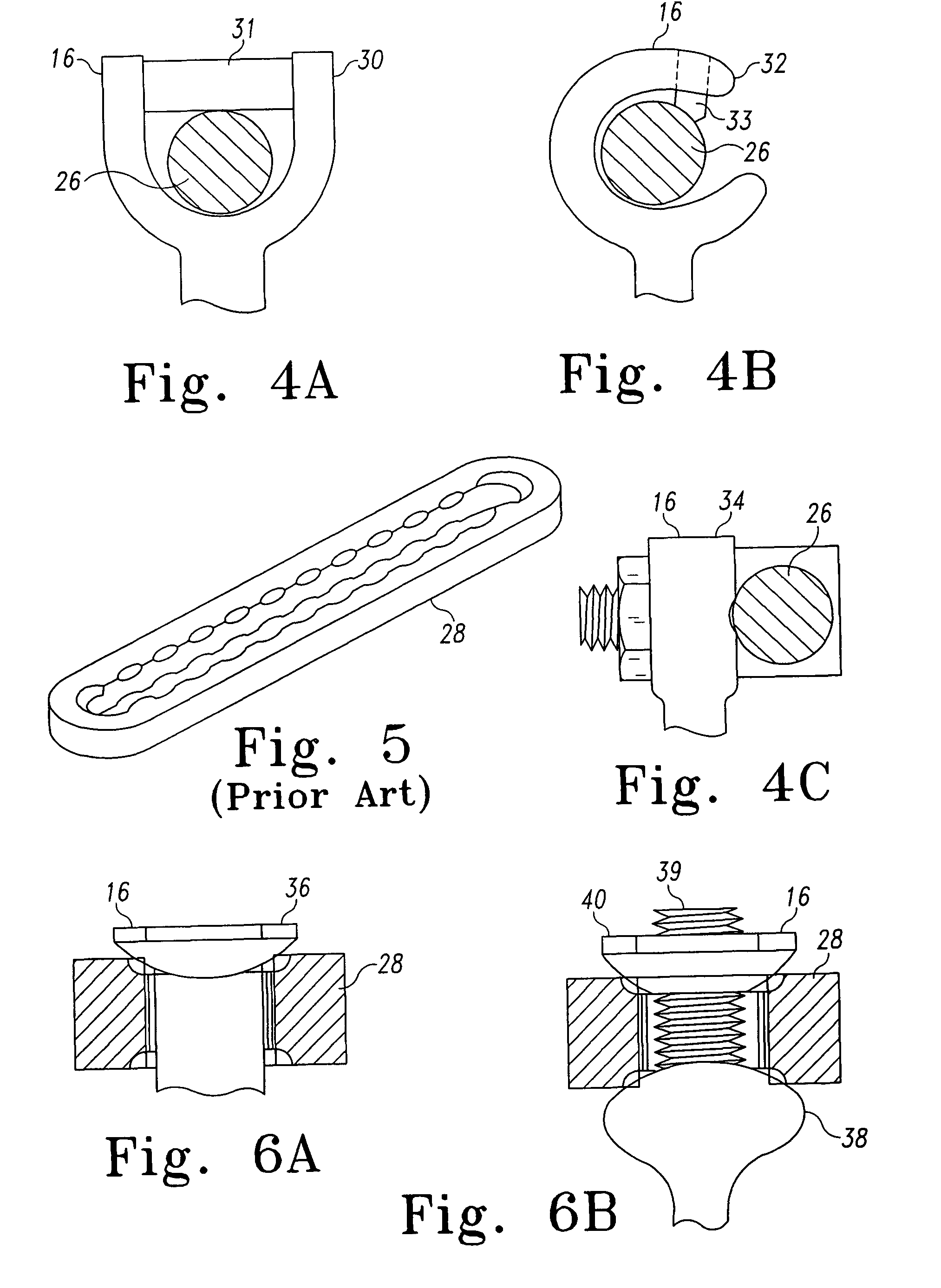 Dynamic spinal stabilization system