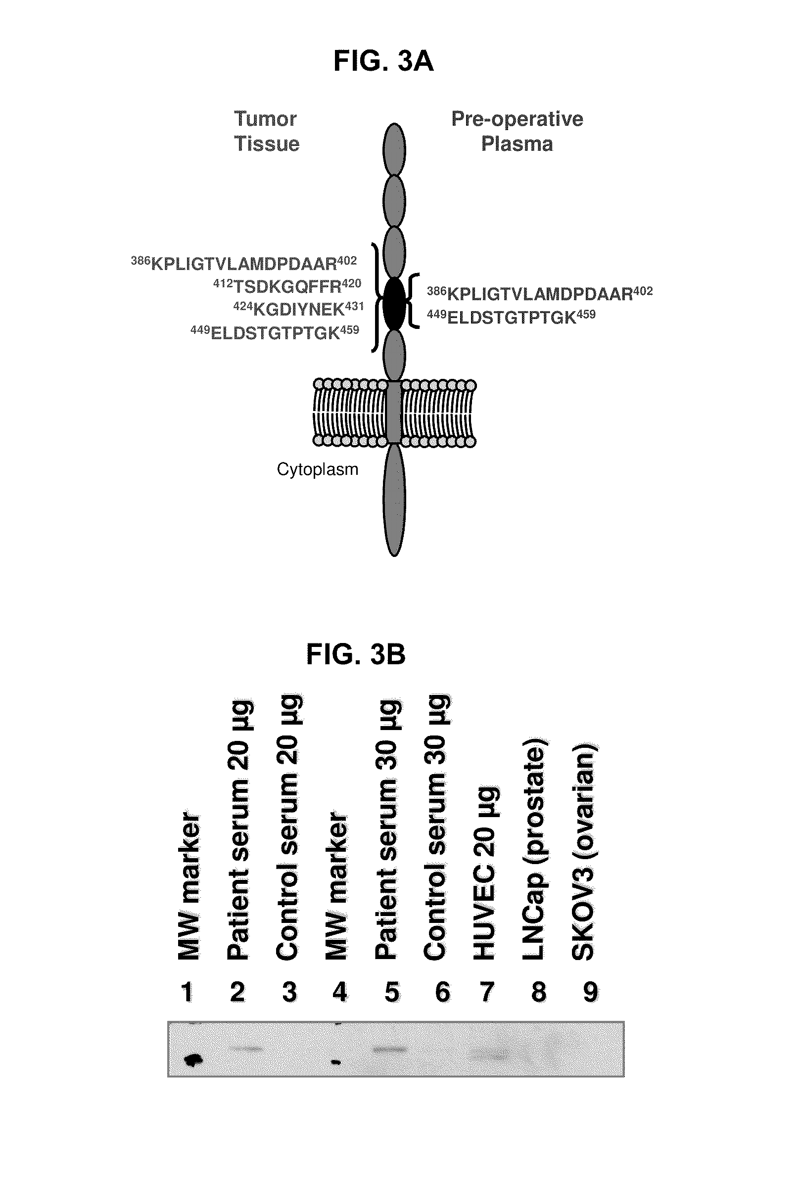 Renal cell carcinoma biomarkers