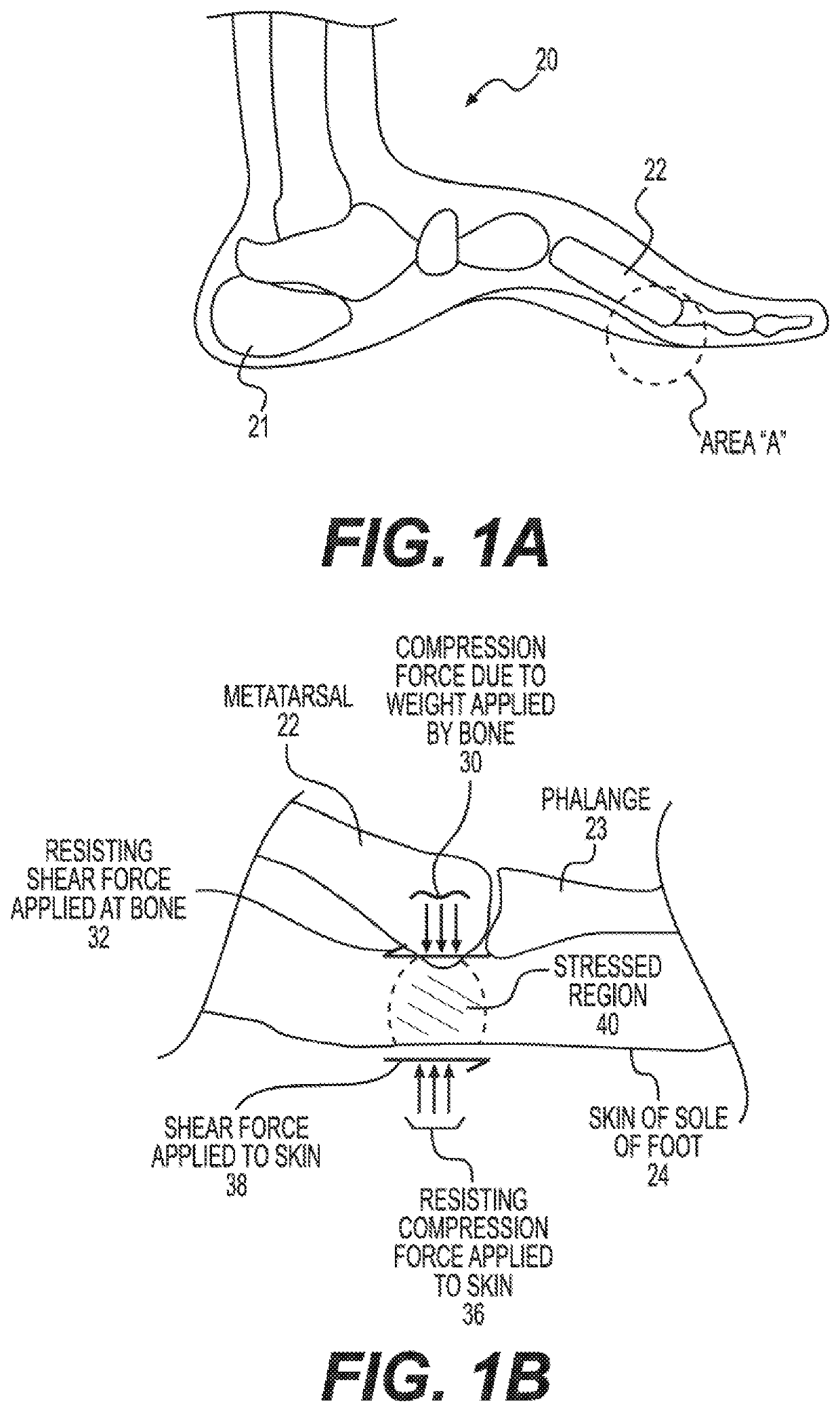 Measurement of Susceptibility to Diabetic Foot Ulcers