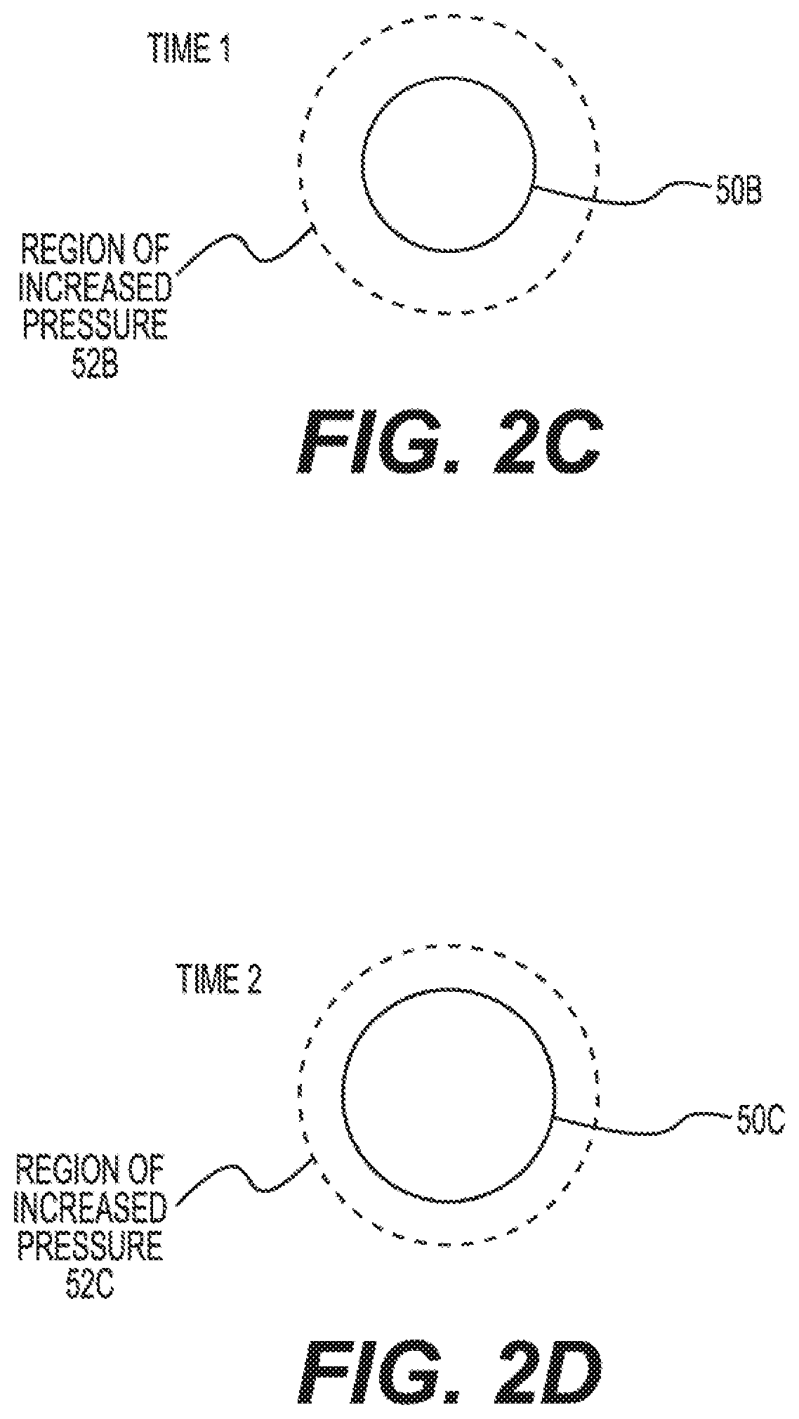 Measurement of Susceptibility to Diabetic Foot Ulcers